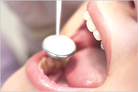 審美歯科治療のイメージ